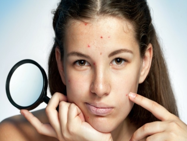 Kinh nguyệt ảnh hưởng đến da như thế nào?